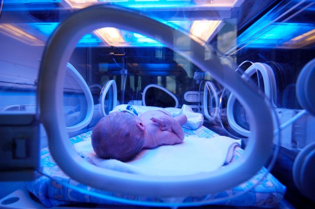 A newborn in the neonatal intensive care unit. Credit: Getty