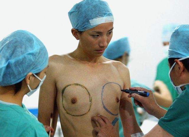 When gender medicine crashed out